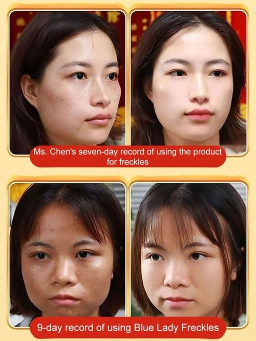 The Clarity Elixir - Erase All Spots, Reveal Radiance - 50% OFF