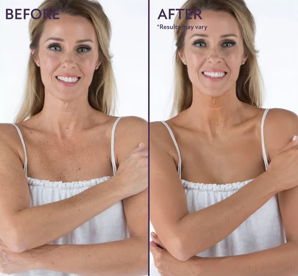 SecondSkin - Your Flawless Face & Body in One - 50% OFF