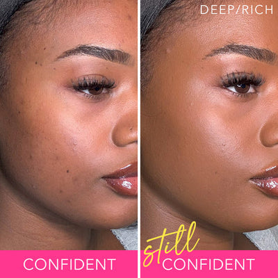 YouthBounce Renew – Rediscover Your Skin’s Youthful Radiance - 1+1 FREE
