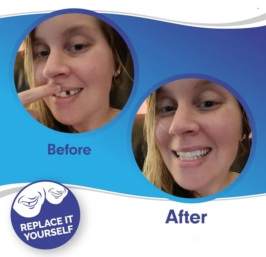 LuminaSmile Instant Confidence Veneers - 50% OFF