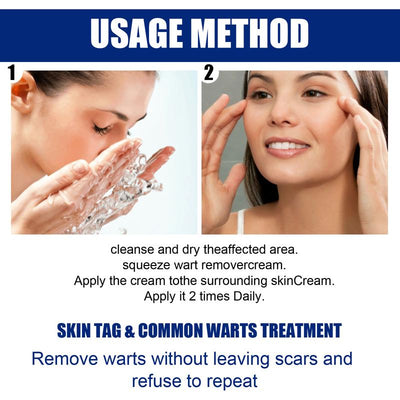 DermaClear Wart Ointment - Your Permanent Skin Solution - 50% OFF