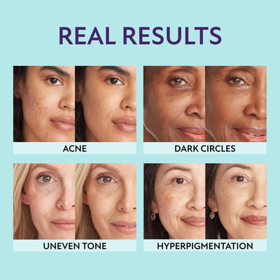 DermaGlow All-in-One Skin Perfecting Cream – Waterproof Body & Face Foundation - 50% OFF