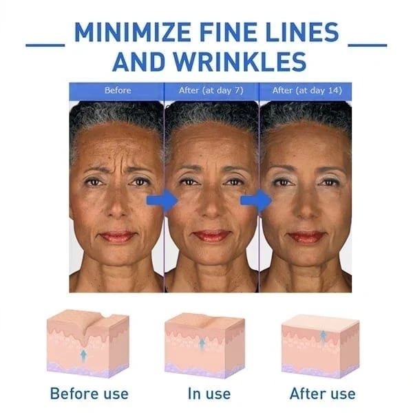 The NeuroTox Serum - The Needle-Free Wrinkle Solution - 50% OFF