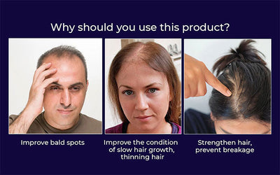 NaturaRevive Hair Spray - 5x Faster Hair Growth + 50% OFF