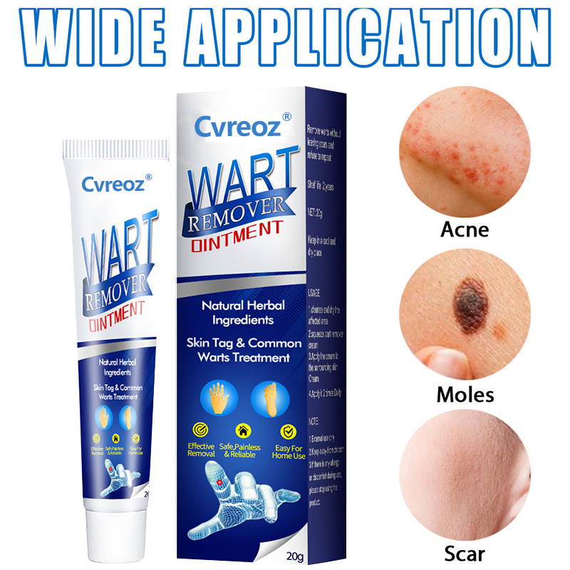DermaClear Wart Ointment - Your Permanent Skin Solution - 50% OFF