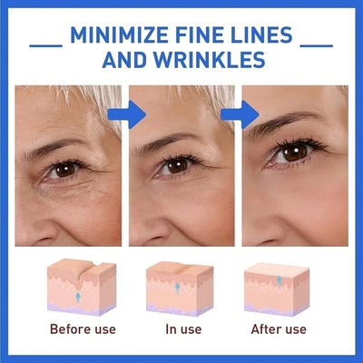 The NeuroTox Serum - The Needle-Free Wrinkle Solution - 50% OFF