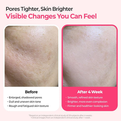 DermaPhase System - Resurface Your Skin, Erase Imperfections - 50% OFF