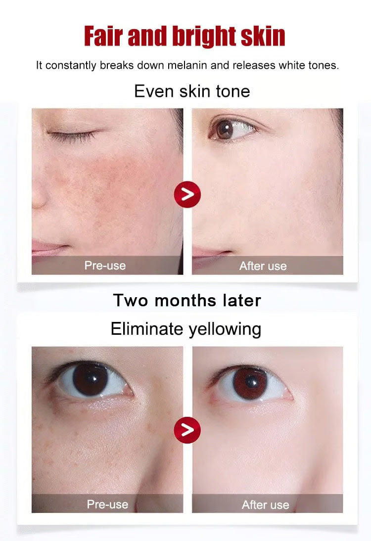 Anti-Blemish & Anti-Aging Tear-Off Mask – Deep Pore Detox - 1+1 FREE