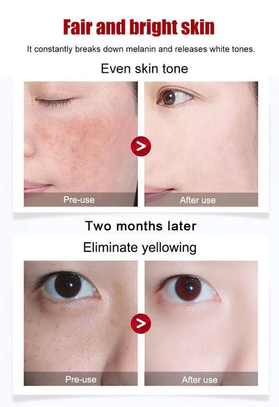 Anti-Blemish & Anti-Aging Tear-Off Mask – Deep Pore Detox - 1+1 FREE