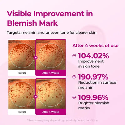 DermaPhase System - Resurface Your Skin, Erase Imperfections - 50% OFF