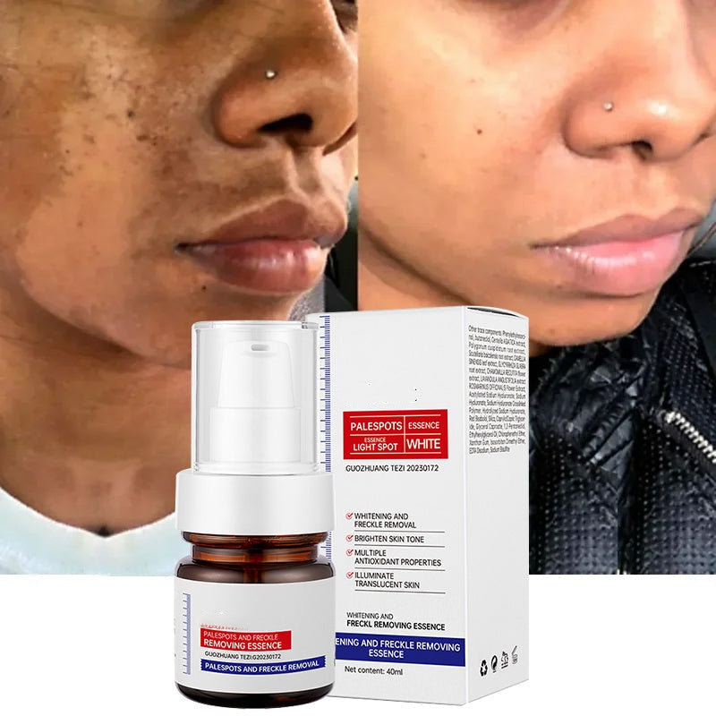 LumaBright - Erase Spots, Reveal Radiance - 50% OFF