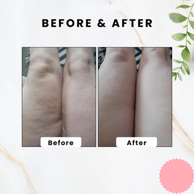 BodySculpt Stone - Visibly Smoother Skin in Weeks - 50% OFF