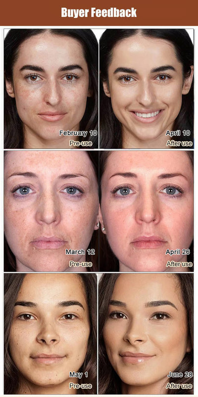 Anti-Blemish & Anti-Aging Tear-Off Mask – Deep Pore Detox - 1+1 FREE