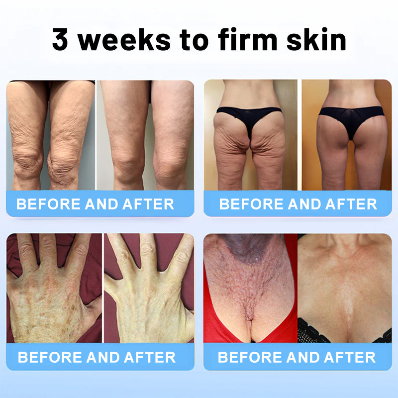 ElastiTox Firming Serum Stick – Sculpt, Lift, Defy Gravity - 50% OFF