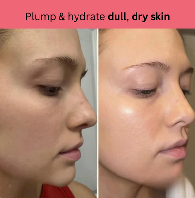 GoldenGlow Sleep Mask - Wake Up to Glowing Skin + 50% OFF