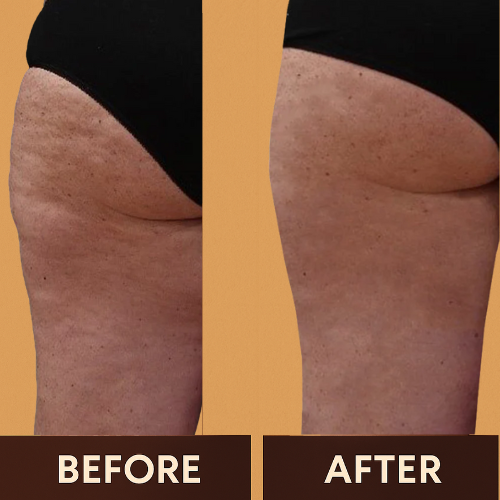 DermaSculpt Oil - Visibly Smooth Your Skin - 50% OFF