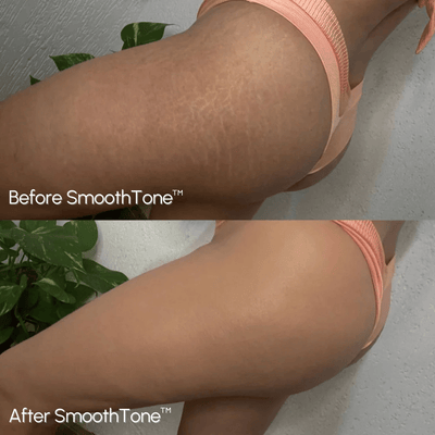 DermaBlend Perfector – Your Flawless Skin Canvas - 50% OFF