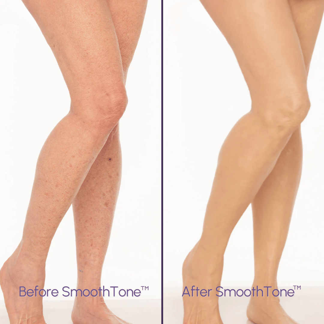 DermaBlend Perfector – Your Flawless Skin Canvas - 50% OFF