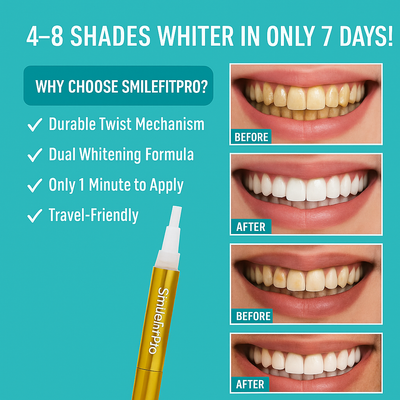 SmileFitPro Whitening Pen - A Whiter Smile, No Sensitivity + 50% OFF