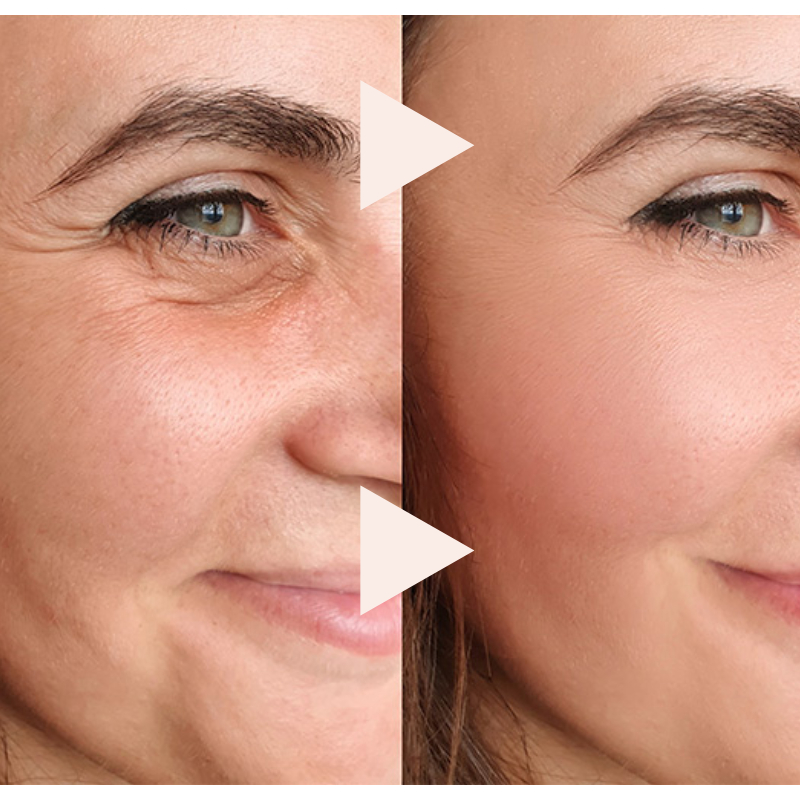 The 10-Second Wrinkle Eraser - An Instant Lift in a Stick + 50% OFF