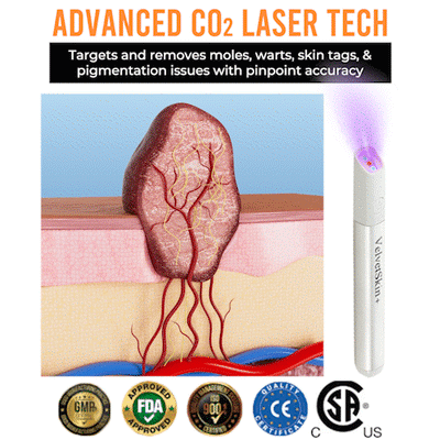 QIAWI CO₂ Laser Pen - Remove Skin Imperfections at Home + 50% OFF