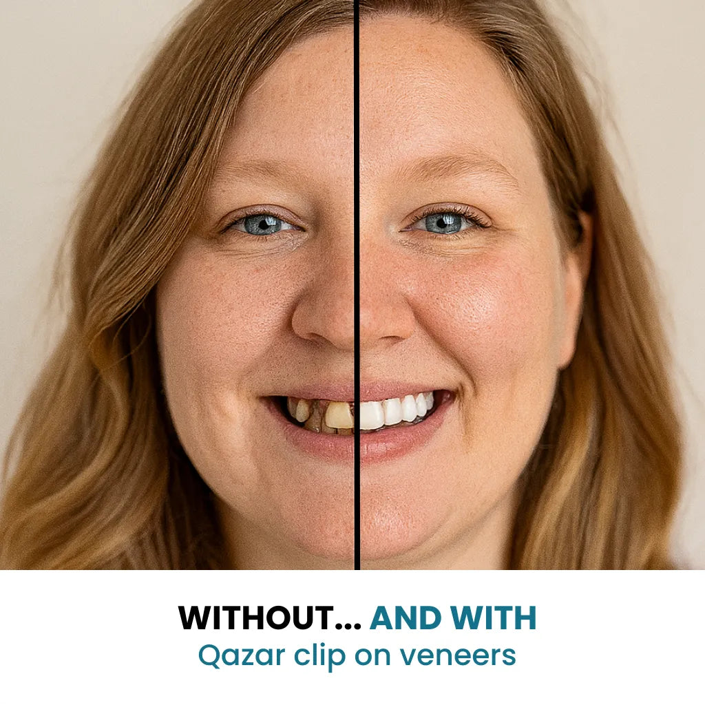 SecureSmile - Your Perfect Smile, in 5 Minutes - 50% OFF