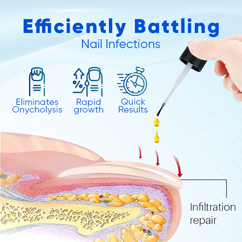 OnyxaCare Nail Growth and Repair Serum – Strengthen, Repair & Grow - 1+1 FREE