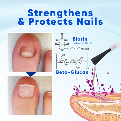 OnyxaCare Nail Growth and Repair Serum – Strengthen, Repair & Grow - 1+1 FREE
