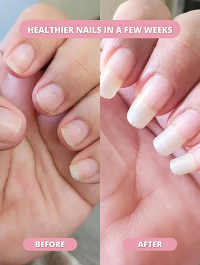 KeraStrong - The Nail Rebuilding Elixir - 50% OFF