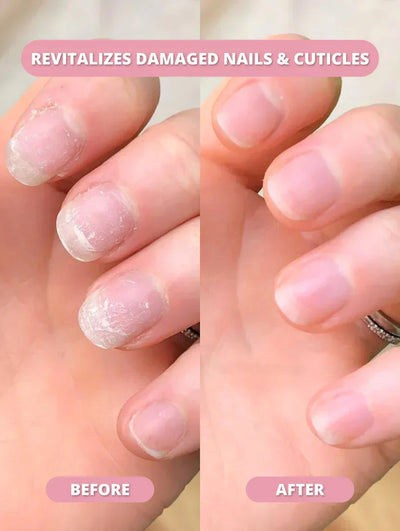 KeraStrong - The Nail Rebuilding Elixir - 50% OFF