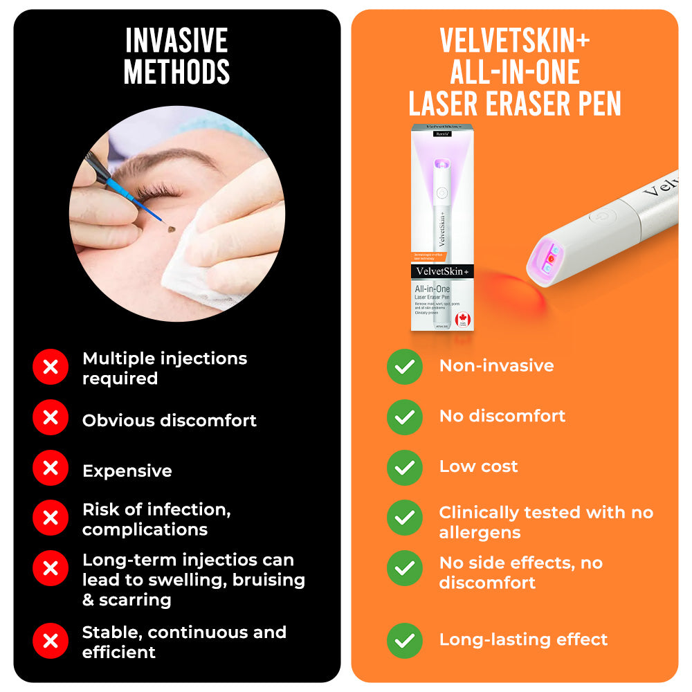 QIAWI CO₂ Laser Pen - Remove Skin Imperfections at Home + 50% OFF