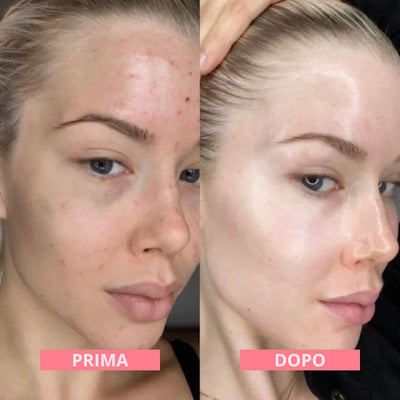 DermalFuse Hydro-Mask - Wake Up With Glass Skin - 50% OFF