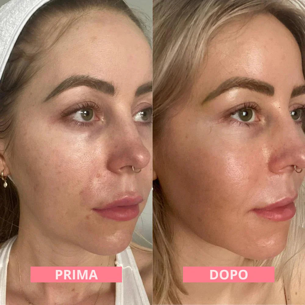 DermalFuse Hydro-Mask - Wake Up With Glass Skin - 50% OFF