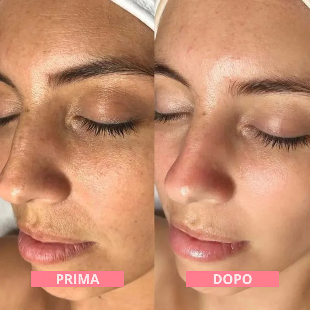 DermalFuse Hydro-Mask - Wake Up With Glass Skin - 50% OFF