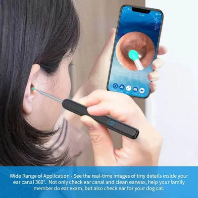 OtoScope HD - Clean Your Ears Safely, See Everything - 50% OFF