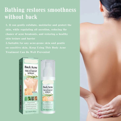 Back Acne Spray Fast-Acting Body Blemish Treatment for Women - Clear Skin Without the Harshness - 1+1 FREE