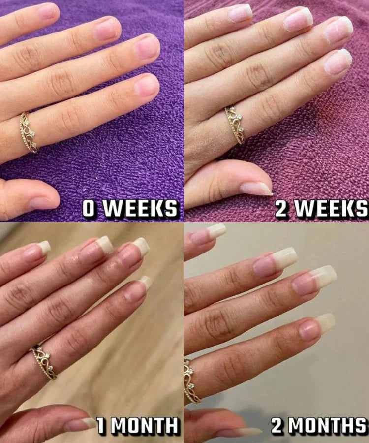 KeraStrong - The Nail Rebuilding Elixir - 50% OFF