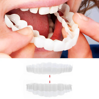LuminaSmile Instant Confidence Veneers - 50% OFF
