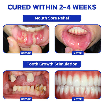 Nexisify  Focussmile Powder - Stronger Teeth & Gums + 50% OFF