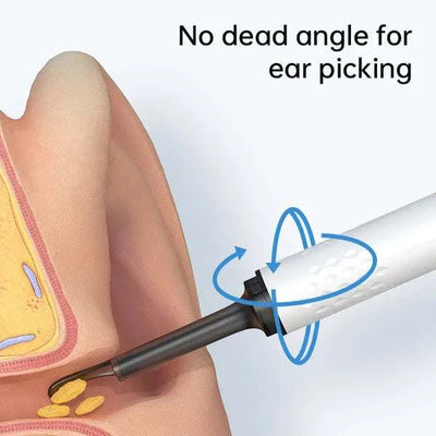 OtoScope HD - Clean Your Ears Safely, See Everything - 50% OFF