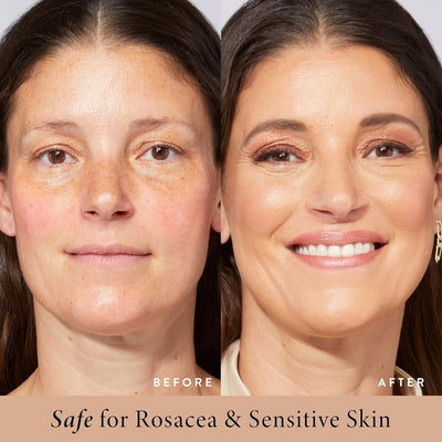 ChromaVeil CC Cream - Your Perfect Skin in One Step - 50% OFF