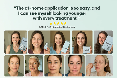 ChronoStamp - Unlock Your Skin's Full Potential - 50% OFF