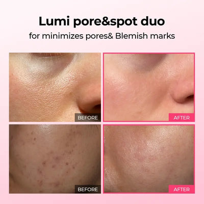DermaPhase System - Resurface Your Skin, Erase Imperfections - 50% OFF