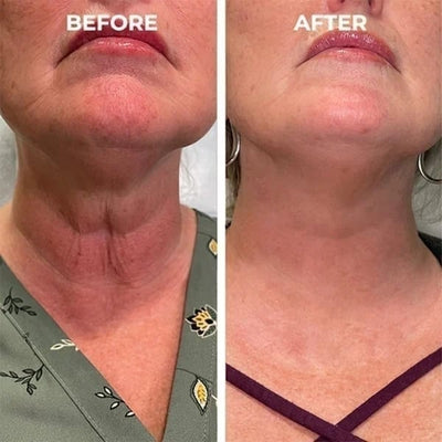 The NeuroTox Serum - The Needle-Free Wrinkle Solution - 50% OFF