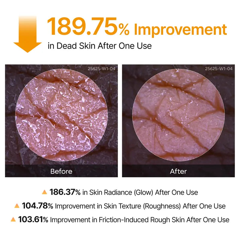 The Radiance Peel Spray - Smooth Bumps, Instant Glow + 50% OFF