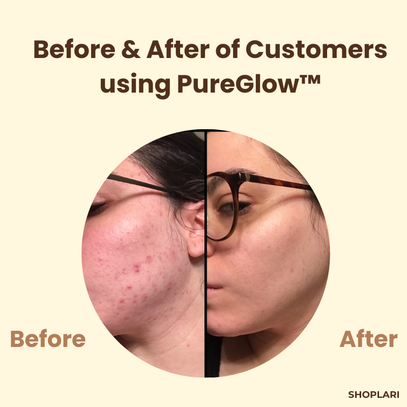 The PureGlow  Black Tea Mask - A Total Skin Reset in a Jar + 1+1 FREE