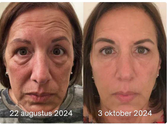 LumiVive – Reclaim Youthful Radiance - 50% OFF