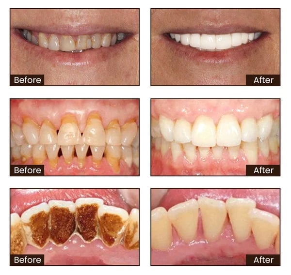 NiacinBright Toothpaste - Reveal your brightest, healthiest, dentist-approved smile