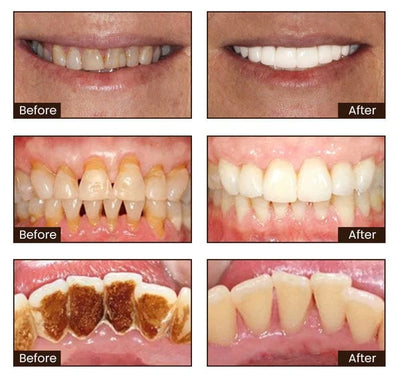 NiacinBright Toothpaste - Reveal your brightest, healthiest, dentist-approved smile