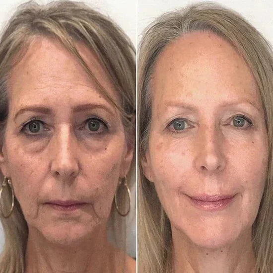 ClearGleam Vitamin B5 Serum – Your Fast-Track to Radiant, Hydrated Skin - 1+1 FREE